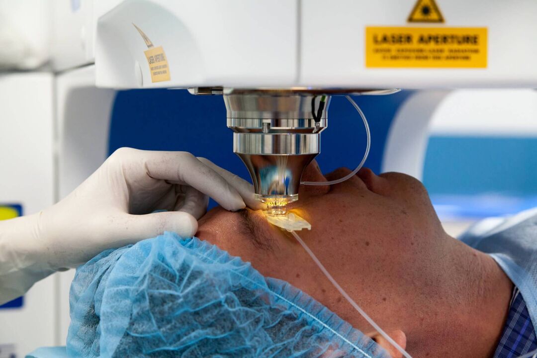 Laser Chirurgie fir d'Visioun ze restauréieren